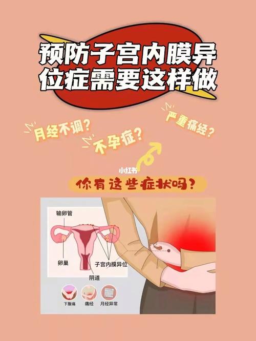 怎样预防腹部子宫内膜异位复发 2015抚顺市臧霭竹专家文章