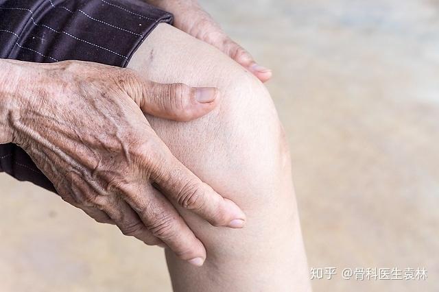老年人膝关节炎如何治疗