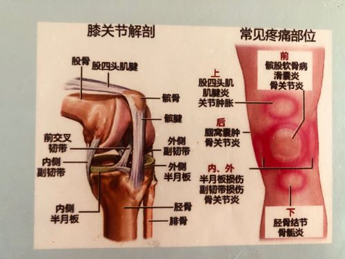 膝盖关节炎引起整条腿肿胀疼痛 2002郑州市蔡义影专家文章