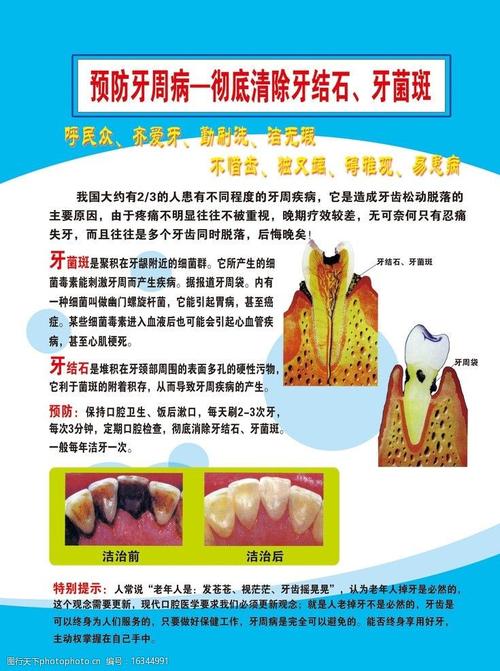 买防蛀的牙膏能预防牙菌斑吗 2013温州市寿莉兰推荐文章