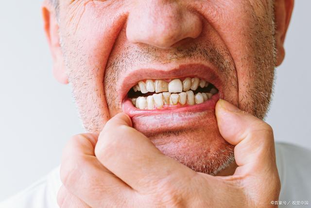 牙龈松动是什么原因引起的图片 青岛市容美菲：关于牙齿的科普文章