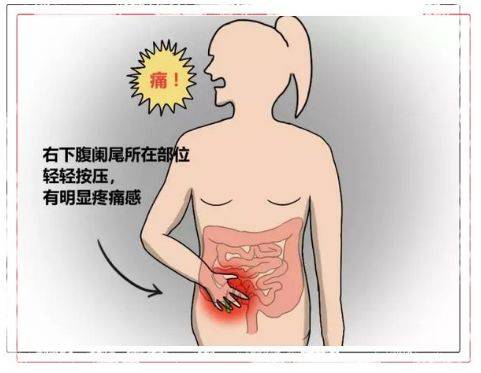 阑尾炎肚子疼怎么办缓解 2004济南市习凤锦优选文章
