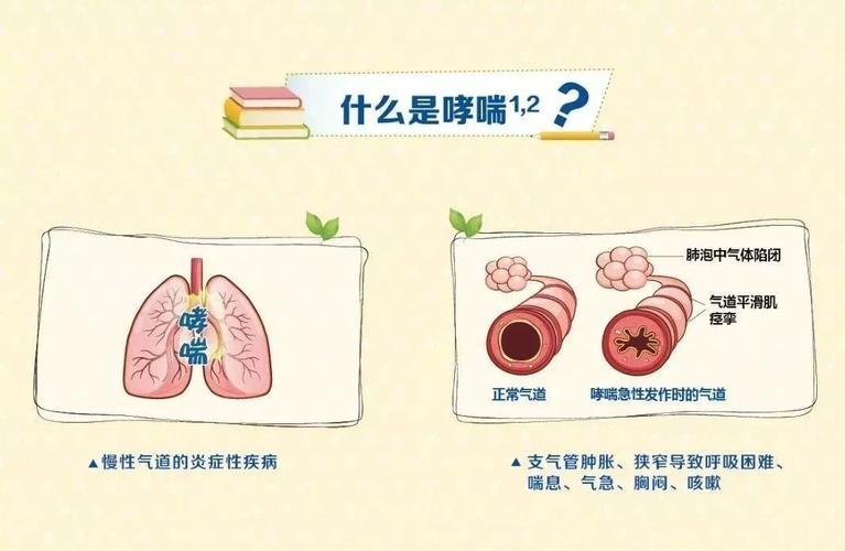 儿童支气管哮喘可以治愈吗 2021东营市古婉真优选文章