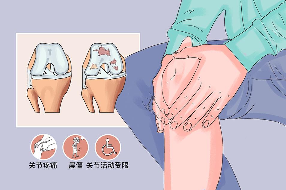 膝关节炎的治疗方法 2010台州市闻伊颖优选文章