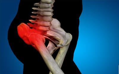 下楼膝关节痛怎么办 2013自贡市和凯素专家文章
