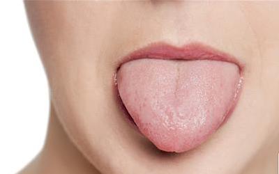 舌头上的牙痕如何处理