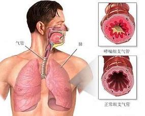 儿童支气管哮喘自愈的十大方法 2002东营市居琰姣日常科普