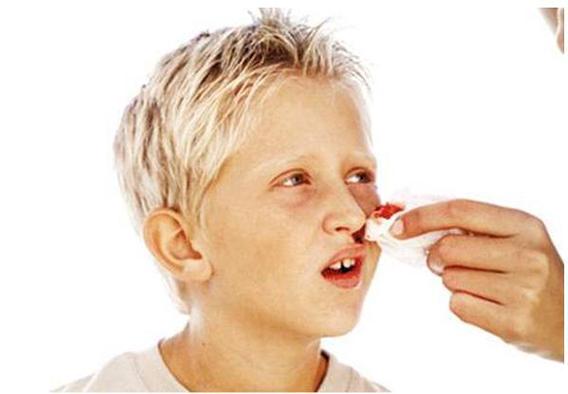 小孩流鼻血是什么原因一问一答 2014梧州市农嘉英日常科普