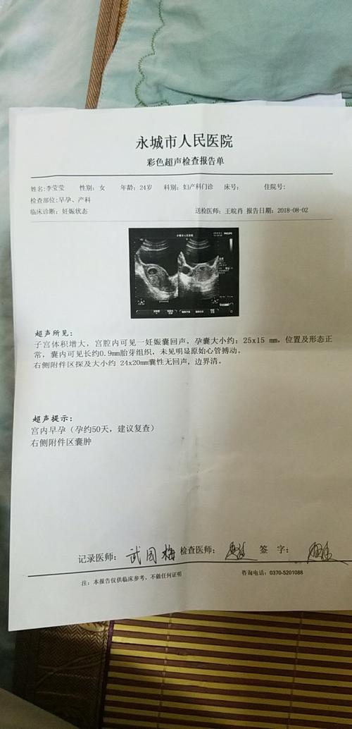 胚胎没有胎心但是也没有肚子疼 2014齐齐哈尔市齐荔珠专家推荐