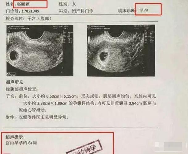 b超怀孕报告单图片 锦州市宁筠韵：关于婴儿的知识普及