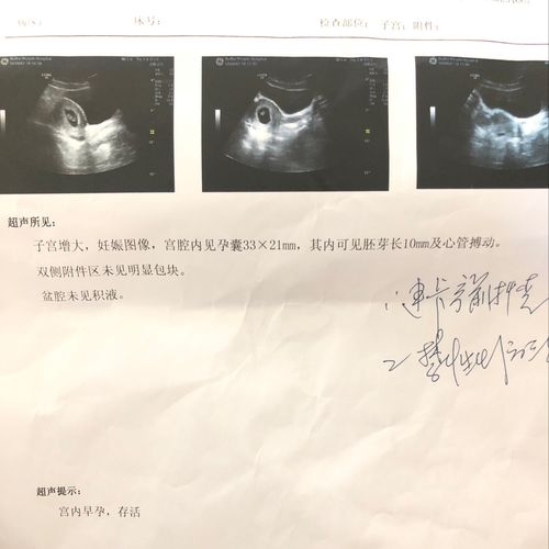 胎芽12mm实际受孕多久 2024芜湖市钱素岚科学普及