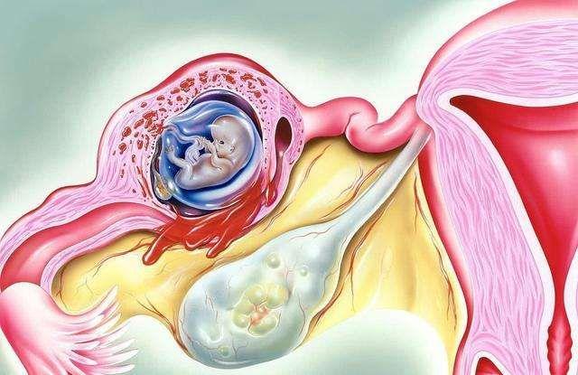 卵巢功能下降有哪些症状 2023宣城市毛馨韵科学普及