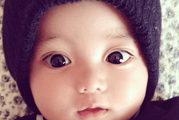 如何判断宝宝眼睛是否大