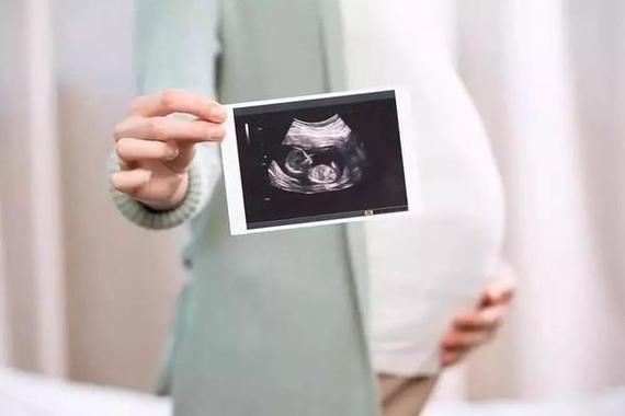 移植怀孕后第一次b超查什么 2001青海伍忠红科普文章